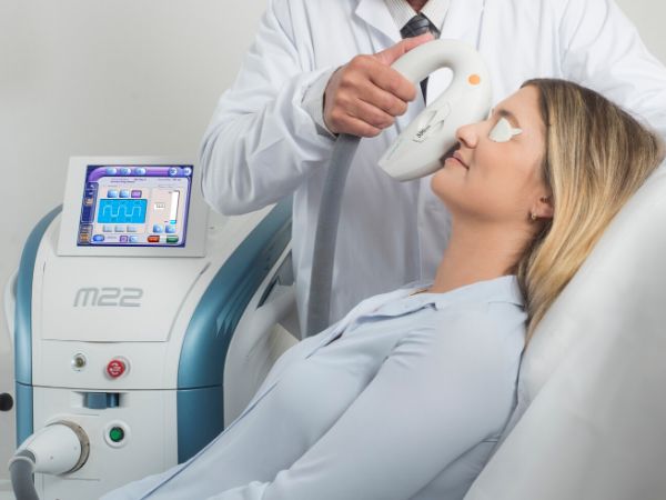 ¿Por qué tratar la blefaritis con IPL?
