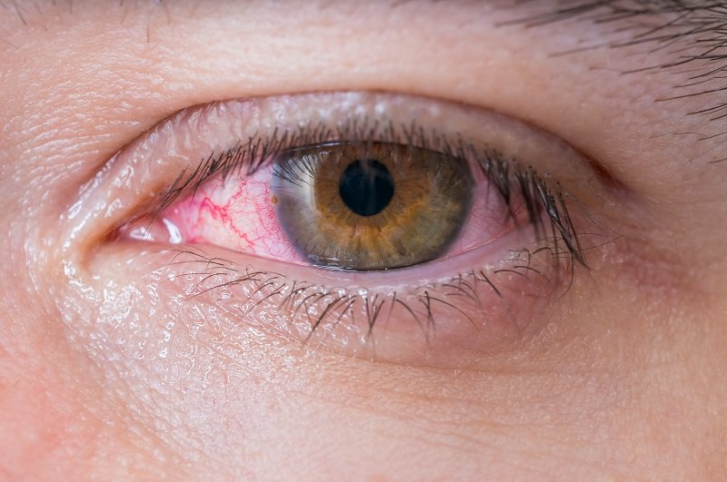 ¿Cómo afectan los cosméticos al ojo seco?