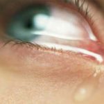 epifora-ocular-asociada-covid-19