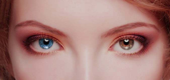 Heterocromía del iris, la causa de tener ojos de diferente color