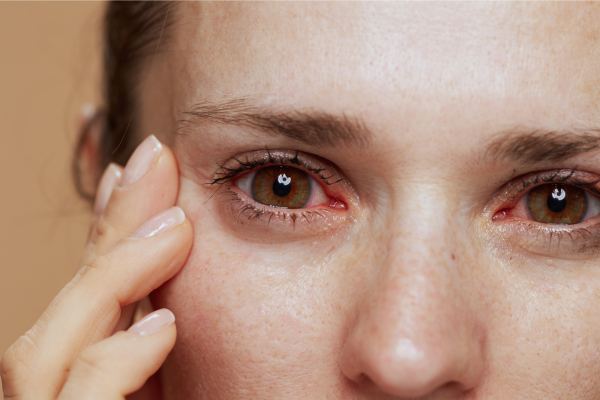 Síntomas de los hongos en los ojos