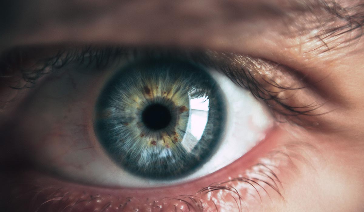 ¿Qué es el Melanoma Ocular?